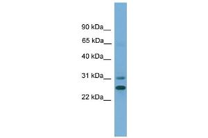 WB Suggested Anti-DHRS2  Antibody Titration: 0. (DHRS2 Antikörper  (N-Term))
