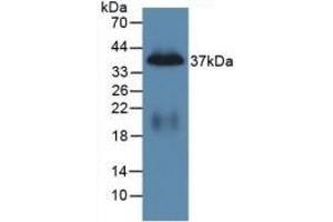 Detection of Recombinant PP, Mouse using Polyclonal Antibody to Pancreatic Polypeptide (PP)