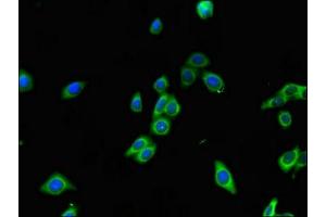 Immunofluorescent analysis of HepG2 cells using ABIN7167377 at dilution of 1:100 and Alexa Fluor 488-congugated AffiniPure Goat Anti-Rabbit IgG(H+L) (RAB7A Antikörper  (AA 110-177))