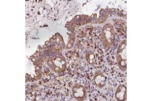Immunohistochemical staining of human rectum with METTL22 polyclonal antibody  shows moderate cytoplasmic positivity in glandular cells.