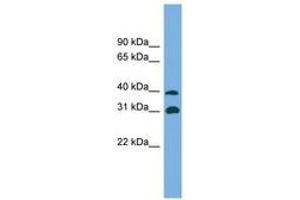 Image no. 1 for anti-Crystallin, mu (CRYM) (AA 179-228) antibody (ABIN6743608)