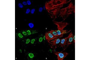 Immunocytochemistry/Immunofluorescence analysis using Mouse Anti-Cav3. (CACNA1G Antikörper  (AA 2052-2172) (FITC))