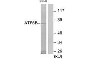 Western blot analysis of extracts from COLO205 cells, using ATF6B Antibody. (ATF6B Antikörper  (AA 401-450))