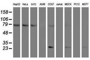 Image no. 1 for anti-Folate Hydrolase (Prostate-Specific Membrane Antigen) 1 (FOLH1) antibody (ABIN1500455) (PSMA Antikörper)