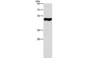 Western Blot analysis of Mouse pancreas tissue using ILK Polyclonal Antibody at dilution of 1:550 (ILK Antikörper)