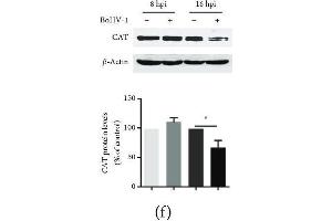 The effects of BoHV-1 infection on the gene expression of antioxidant enzymes.