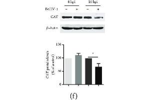 The effects of BoHV-1 infection on the gene expression of antioxidant enzymes. (Catalase Antikörper  (AA 1-225))