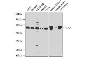 Western blot analysis of extracts of various cell lines using MICA Polyclonal Antibody at dilution of 1:1000. (MICA Antikörper)