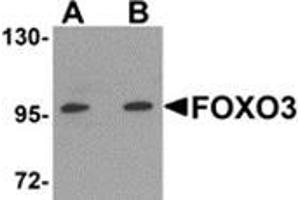 Western blot analysis of FOXO3 in A-20 cell lysate with FOXO3 antibody at (A) 0. (FOXO3 Antikörper  (N-Term))