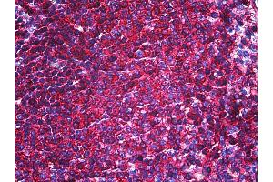Anti-CD44 antibody IHC of human spleen. (CD44 Antikörper)