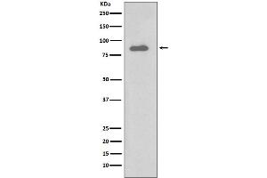 Western Blotting (WB) image for anti-conserved Helix-Loop-Helix Ubiquitous Kinase (CHUK) antibody (ABIN7606904)