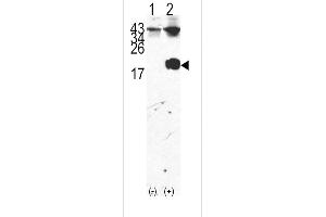 Western blot analysis of FKBP12 (arrow) using rabbit polyclonal FKBP12 Antibody (Center) (ABIN392172 and ABIN2841886). (FKBP1A Antikörper  (AA 43-74))