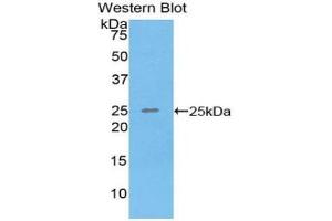 Western blot analysis of the recombinant protein. (SPRY3 Antikörper  (AA 91-288))