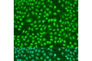 Immunofluorescence analysis of U2OS cells using PSEN2 Polyclonal Antibody at dilution of 1:100. (Presenilin 2 Antikörper)