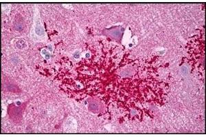 Human Brain, Astrocytes Microglia: Formalin-Fixed, Paraffin-Embedded (FFPE) (CXCR4 Antikörper  (C-Term))
