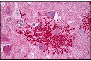 Human Brain, Astrocytes Microglia: Formalin-Fixed, Paraffin-Embedded (FFPE)