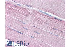 ABIN185598 (5µg/ml) staining of paraffin embedded Human Skeletal Muscle. (SORBS1 Antikörper  (Internal Region))