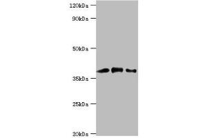 Western blot All lanes: Macrophage-capping protein antibody at 1 μg/mL Lane 1: Hela whole cell lysate Lane 2: NIH/3T3 whole cell lysate Lane 3: Rat lung tissue Secondary Goat polyclonal to rabbit IgG at 1/10000 dilution Predicted band size: 39, 37 kDa Observed band size: 39 kDa (CAPG Antikörper  (AA 1-348))