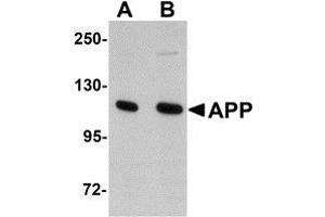 Western blot analysis of APP in rat brain tissue lysate with AP30073PU-N APP antibody at (A) 1 and (B) 2 μg/ml. (APP Antikörper  (N-Term))