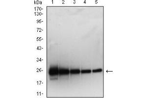 Western blot analysis using SARS-Cov2-NP2 mAb against human SARS-Cov2-N (AA: 120-300) recombinant protein. (SARS-Cov2-NP2 (AA 120-300) Antikörper)