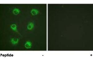 Immunofluorescence analysis of HUVEC cells, using CRKL polyclonal antibody . (CrkL Antikörper)