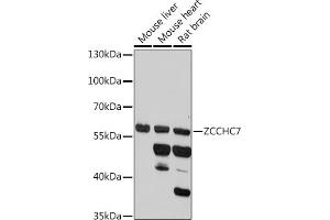 Western blot analysis of extracts of various cell lines, using ZCCHC7 antibody (ABIN7271547) at 1:1000 dilution. (ZCCHC7 Antikörper)