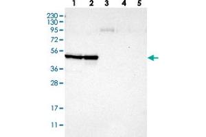Western blot analysis of Lane 1: RT-4, Lane 2: U-251 MG, Lane 3: Human Plasma, Lane 4: Liver, Lane 5: Tonsil with CCNB2 polyclonal antibody  at 1:250-1:500 dilution. (Cyclin B2 Antikörper)