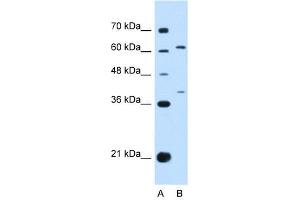 IL28R alpha antibody used at 1 ug/ml to detect target protein.