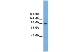 WB Suggested Anti-TTC27 Antibody Titration: 0. (TTC27 Antikörper  (N-Term))