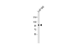 Anti-P4K3 Antibody at 1:1000 dilution + U-87 MG whole cell lysate Lysates/proteins at 20 μg per lane. (MAP4K3 Antikörper)