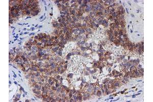 Image no. 5 for anti-Chromosome 21 Open Reading Frame 56 (C21orf56) antibody (ABIN1497041) (C21ORF56 Antikörper)