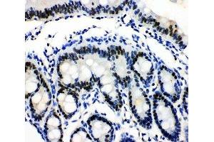 IHC-P: MCM3 antibody testing of rat intestine tissue (MCM3 Antikörper  (N-Term))