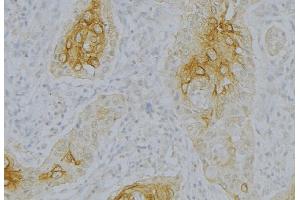 ABIN6276830 at 1/100 staining Human uterus tissue by IHC-P. (Complement Factor B Antikörper  (Internal Region))