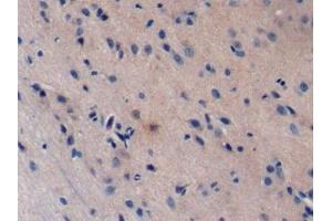 Immunohistochemistry (IHC) image for anti-BH3 Interacting Domain Death Agonist (BID) (AA 1-196) antibody (ABIN7432265)