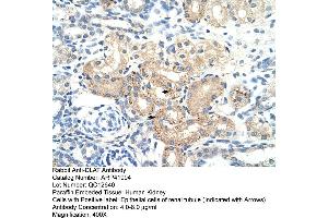 Immunohistochemistry (IHC) image for anti-Dihydrolipoyl Transacetylase (DLAT) (N-Term) antibody (ABIN2777101)
