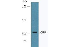 OSBPL1A Antikörper  (AA 851-950)