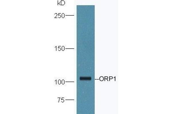 OSBPL1A Antikörper  (AA 851-950)