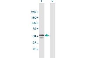 Western Blot analysis of BLMH expression in transfected 293T cell line by BLMH MaxPab polyclonal antibody. (BLMH Antikörper  (AA 1-455))