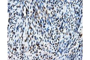 Immunohistochemical staining of paraffin-embedded Kidney tissue using anti-MCL1 mouse monoclonal antibody. (MCL-1 Antikörper)