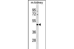 CCDC91 Antibody (C-term) (ABIN1537129 and ABIN2849430) western blot analysis in mouse kidney tissue lysates (35 μg/lane). (CCDC91 Antikörper  (C-Term))