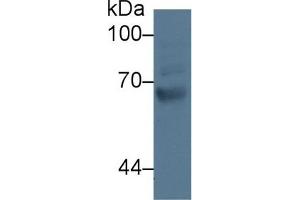 Western Blot; Sample: Human Jurkat cell lysate; Primary Ab: 3µg/ml Rabbit Anti-Human GRK4 Antibody Second Ab: 0.