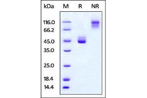 Cynomolgus TIGIT, Fc Tag on SDS-PAGE under reducing (R) and no-reducing (NR) conditions. (TIGIT Protein (AA 89-208) (Fc Tag))