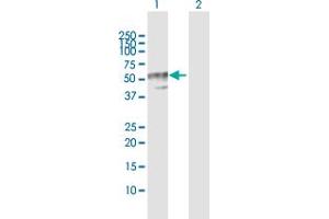 Western Blot analysis of B4GALT3 expression in transfected 293T cell line by B4GALT3 MaxPab polyclonal antibody.