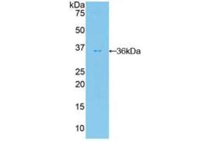 Western blot analysis of recombinant Human FDFT1. (FDFT1 Antikörper  (AA 269-417))