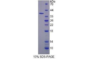 Image no. 1 for Aldehyde Dehydrogenase 3 Family, Member A1 (ALDH3A1) (AA 1-311) protein (His tag) (ABIN6237071)
