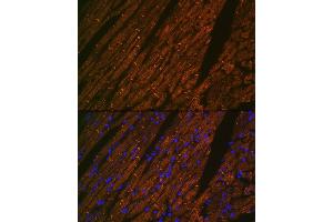 Immunofluorescence analysis of rat heart using Desmin Rabbit mAb (ABIN1678733, ABIN3018020, ABIN3018021 and ABIN7101569) at dilution of 1:100 (40x lens). (Desmin Antikörper)