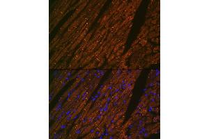 Immunofluorescence analysis of rat heart using Desmin Rabbit mAb (ABIN1678733, ABIN3018020, ABIN3018021 and ABIN7101569) at dilution of 1:100 (40x lens). (Desmin Antikörper)