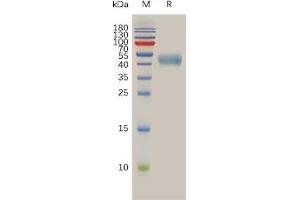 SDS-PAGE (SDS) image for Somatostatin Receptor 2 (SSTR2) (AA 1-43) protein (Fc Tag) (ABIN6964126)