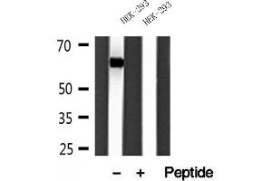 Western blot analysis of extracts of HEK-293 cells, using Sestrin 2 antibody. (Sestrin 2 Antikörper)