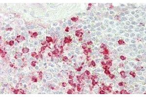Detection of CFD in Human Spleen Tissue using Polyclonal Antibody to Complement Factor D (CFD) (Adipsin Antikörper  (AA 1-253))